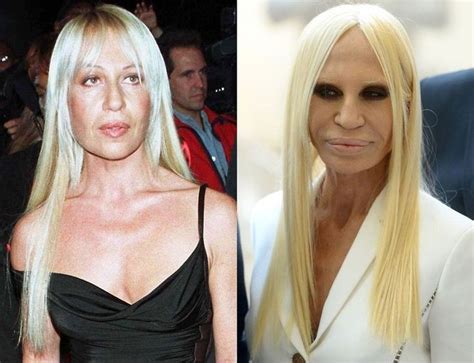 donatella versace in her dress|donatella before and after.